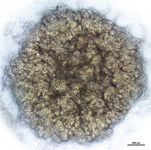 Mini-KIdney Organoids - Grown in a dish using stem cells of a patient with genetic kidney disease